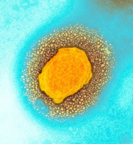 A colored transmission electron micrograph of the monkeypox virus. (Photo credit: UK Health Security Agency/Science Photo Library)