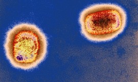The monkeypox virus. (Photo via VCG)