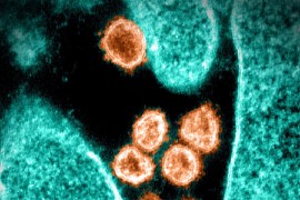Microscopic image of the SARS-COV-2 virus that causes COVID-19. Image: National Institute of Allergy and Infectious Diseases via AFP